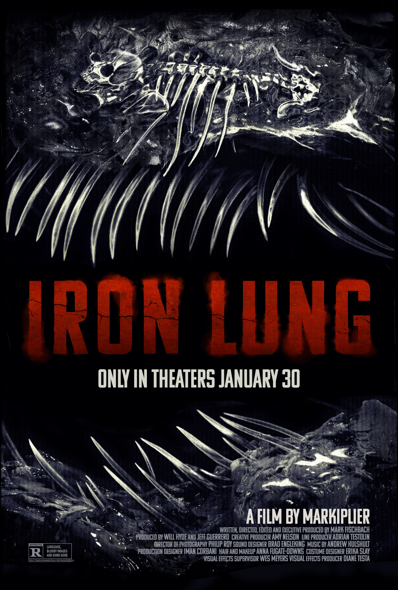 iron lung